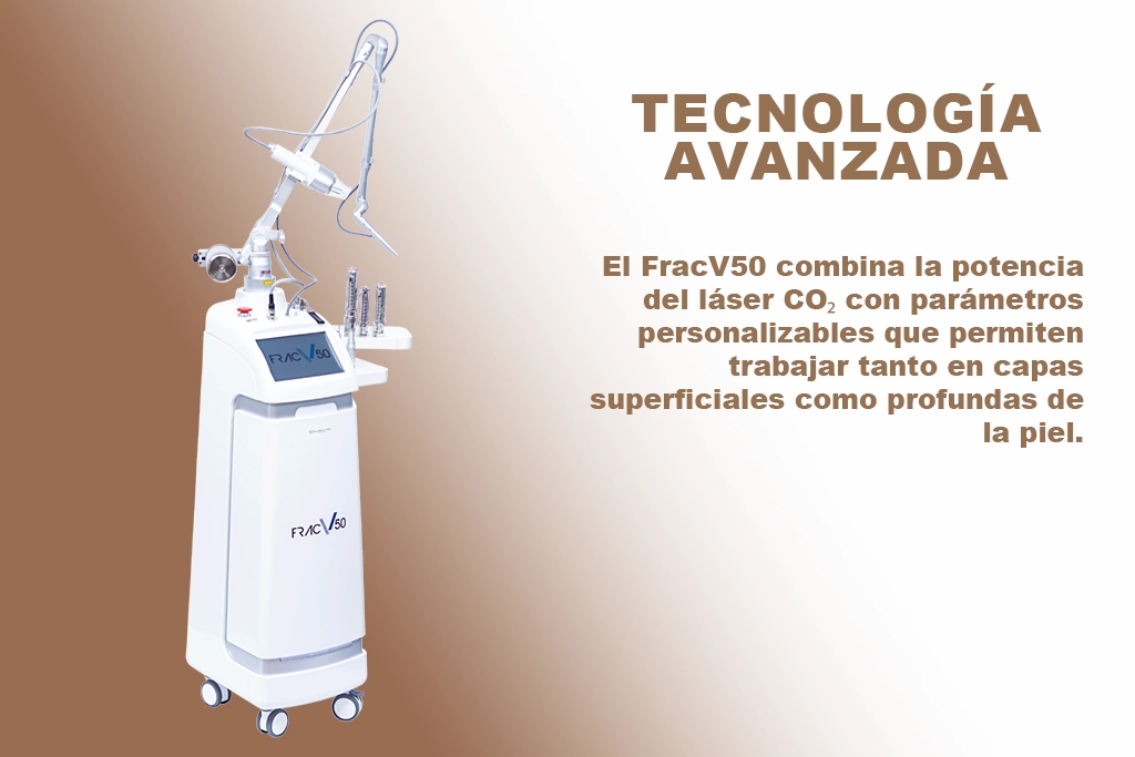 FracV50 annie lasso popayan